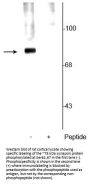 Anti-Phospho-Synapsin I (Ser62,67) Syn1 Antibody