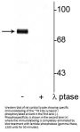 Anti-Phospho-Synapsin I (Ser9) Syn1 Antibody