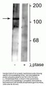 Anti-Phospho-GABAB R2 (Ser783) GABBR2 Antibody