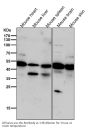 Anti-Phospho-PKA R2 (S99) PRKAR2A Rabbit Monoclonal Antibody