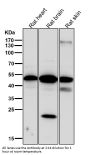 Anti-Phospho-PKA R2 (S99) PRKAR2A Rabbit Monoclonal Antibody