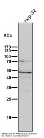 Anti-Phospho-PKA R2 (S99) PRKAR2A Rabbit Monoclonal Antibody