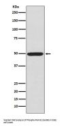 Anti-Phospho-PKA R2 (S99) PRKAR2A Rabbit Monoclonal Antibody