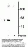 Anti-Phospho-Che-1 (AATF) (Ser477) Antibody