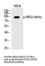 Anti-Phospho-PKD2 (Ser876) PRKD2 Antibody