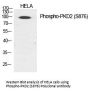 Anti-Phospho-PKD2 (Ser876) PRKD2 Antibody