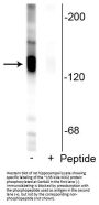 Anti-Phospho-Potassium Chloride Cotransporter 2 (KCC2) (Ser940) SLC12A5 Antibody