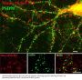 Anti-Phospho-Munc-18 (Ser513) STXBP2 Antibody