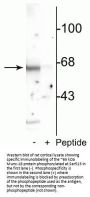 Anti-Phospho-Munc-18 (Ser513) STXBP2 Antibody