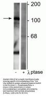 Anti-Phospho-GABAB R1 (Ser923) Antibody