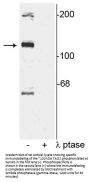 Anti-Phospho-TAO2 (Ser181) TAOK2 Antibody