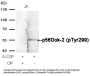 Anti-Phospho-p56Dok-2 (Tyr299) Antibody
