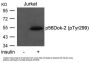 Anti-Phospho-p56Dok-2 (Tyr299) Antibody