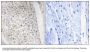 Anti-Phospho PKD1/2/3/PKC mu (Ser738+Ser742) PRKD1 Antibody