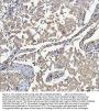 Anti-SSH3BP1/ABI1 Antibody Picoband®
