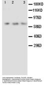 Anti-Angiopoietin 2/ANGPT2 Antibody Picoband®