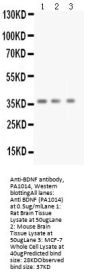 Anti-BDNF Antibody Picoband®