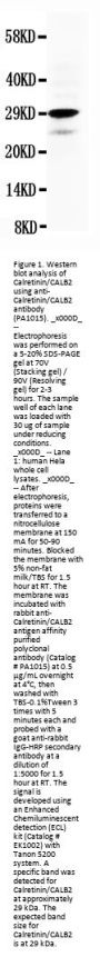 Anti-Calretinin/CALB2 Antibody Picoband®