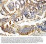 Anti-Calretinin/CALB2 Antibody Picoband®