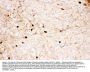 Anti-Calretinin/CALB2 Antibody Picoband®