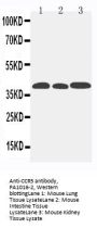 Anti-C-C chemokine receptor type 5 CCR5 Antibody Picoband®