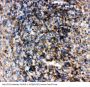 Anti-B-cell receptor CD22 CD22 Antibody Picoband®
