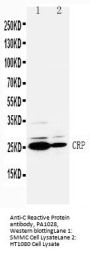 Anti-C Reactive Protein/CRP Antibody Picoband®