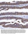 Anti-GST3/GST pi/GSTP1 Antibody Picoband®