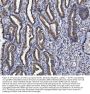Anti-GST3/GST pi/GSTP1 Antibody Picoband®