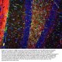 Anti-Myelin Basic Protein/MBP Antibody Picoband®
