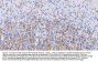 Anti-Myelin Basic Protein/MBP Antibody Picoband®