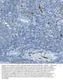 Anti-Myeloperoxidase/MPO Antibody Picoband®