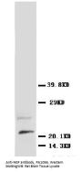 Anti-Beta-nerve growth factor NGF Antibody Picoband®