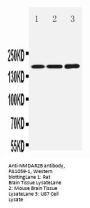 Anti-NMDAR2B/GRIN2B Antibody Picoband®