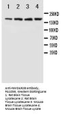 Anti-NMDAR2B/GRIN2B Antibody Picoband®
