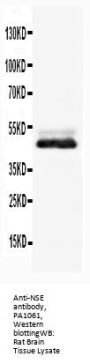 Anti-NSE/ENO2 Antibody Picoband®