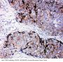 Anti-Metalloproteinase inhibitor 2 TIMP2 Antibody