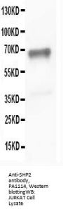 Anti-SHP2/PTPN11 Antibody Picoband®
