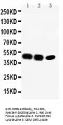 Anti-CCR6/CCR6 Antibody Picoband®