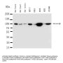 Anti-beta Catenin/CTNNB1 Antibody Picoband®