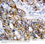 Anti-beta Catenin/CTNNB1 Antibody Picoband®