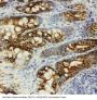 Anti-beta Catenin/CTNNB1 Antibody Picoband®