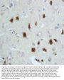 Anti-Hsp70/HSPA1A/HSPA1B Antibody Picoband®
