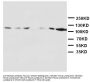 Anti-NMDAR1/GRIN1 Antibody Picoband®