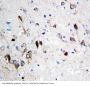 Anti-NMDAR1/GRIN1 Antibody Picoband®