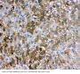 Anti-liver FABP/FABP1 Antibody Picoband®