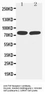 Anti-TNF Receptor II/TNFRSF1B Antibody Picoband®