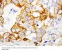 Anti-TNF Receptor II/TNFRSF1B Antibody Picoband®