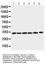 Anti-Cyclin D1/CCND1 Antibody Picoband®