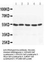 Anti-PPAR gamma/PPARG Antibody Picoband®